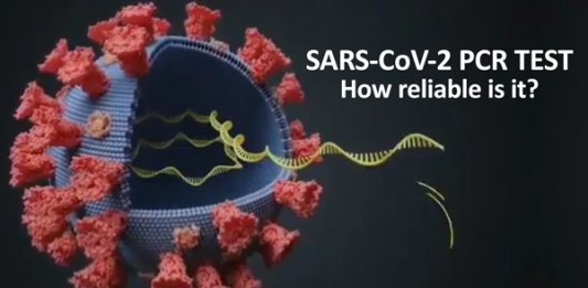 SARS-CoV-2 PCR Test-How Reliable Is It