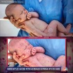 Dreamstime-NBC-News-Baby-Photo-Comparison
