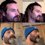 HT’s Nosejob – Before and After