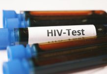 Norwegian effectively cured of HIV after transplant from brother