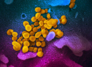 The Bulls*it Never Ends – CDC Reports COVID-19 Activity Is Increasing Across US