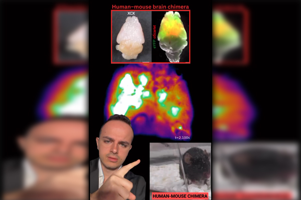 Stanford just created a HUMAN-MOUSE CHIMERA whose cerebral cortex is 92 ...